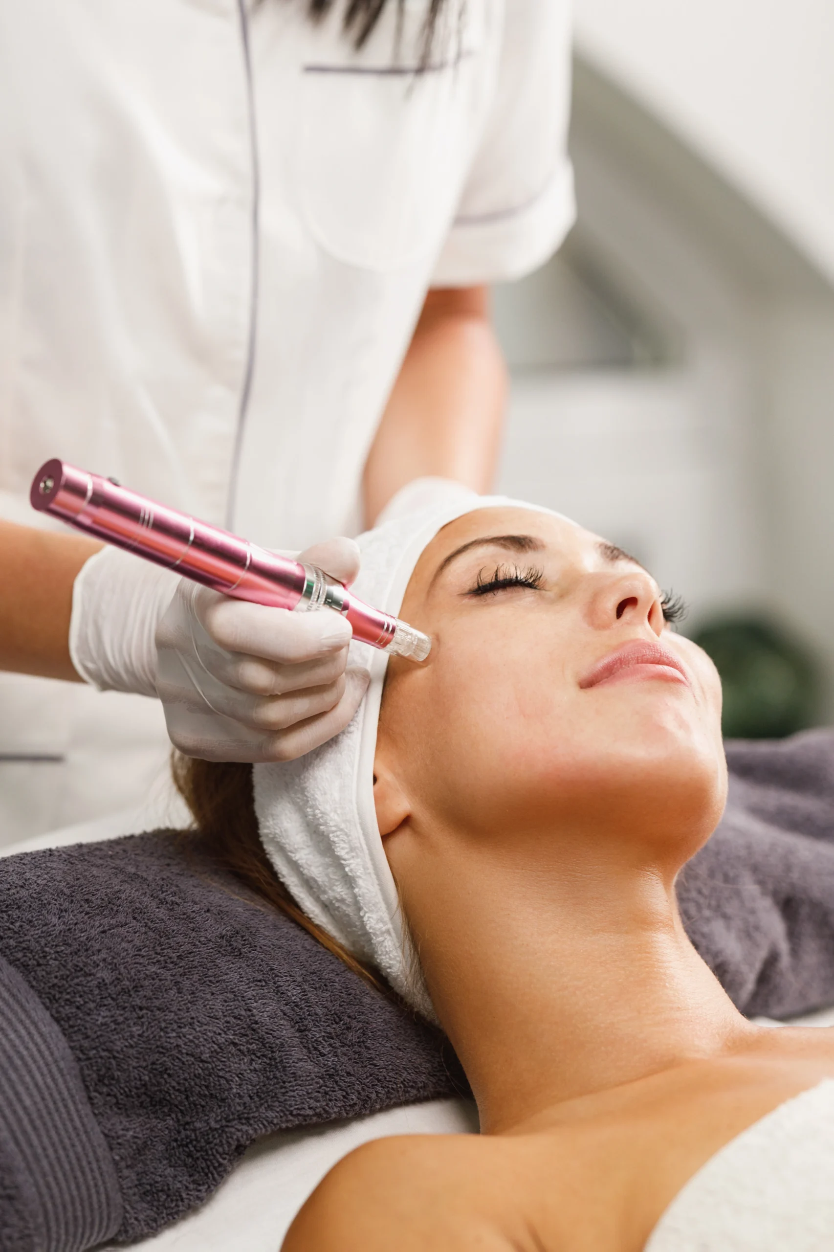 Microneedling in keighley