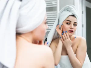 Is Hydrofacial Good for Acne?