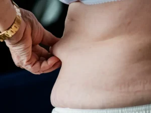 How to Remove a Lipoma Without Surgery-feature