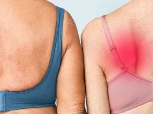 Can a Lipoma Come Back After Removal?