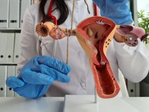 Can Removal of an Ovarian Cyst Cause Infertility?