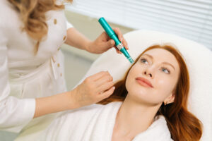 Does Microneedling Tighten Skin