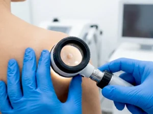 Could a Cyst Be Cancerous