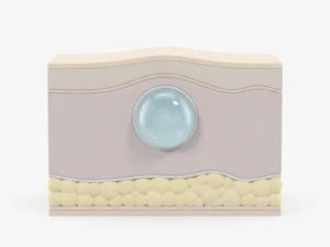 How Can I Get Rid of a Cyst-Featured