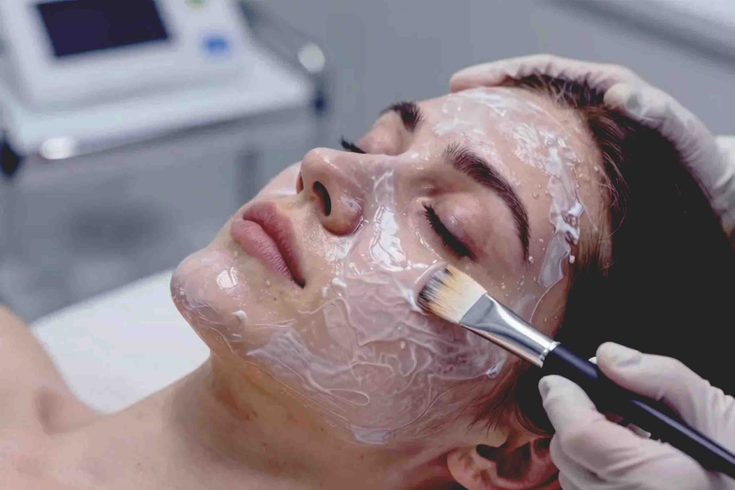 PRP Vampire Facial Keighley