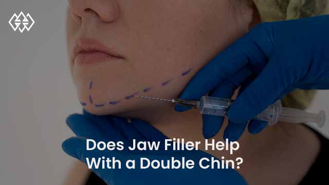 Does Jaw Filler Help With a Double Chin