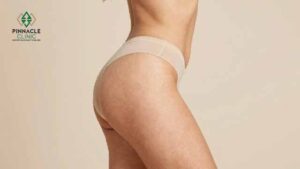 What Is Buttock Augmentation
