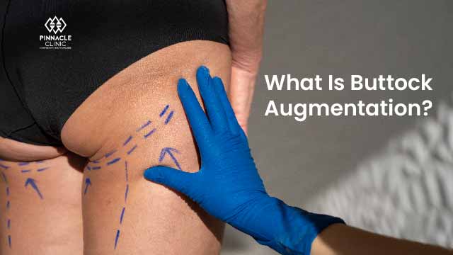 What Is Buttock Augmentation