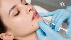 Can You Get Lip Filler While Pregnant