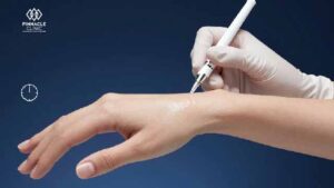 How Long Do Hand Fillers Last