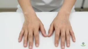 How Long Does Hand Filler Last?