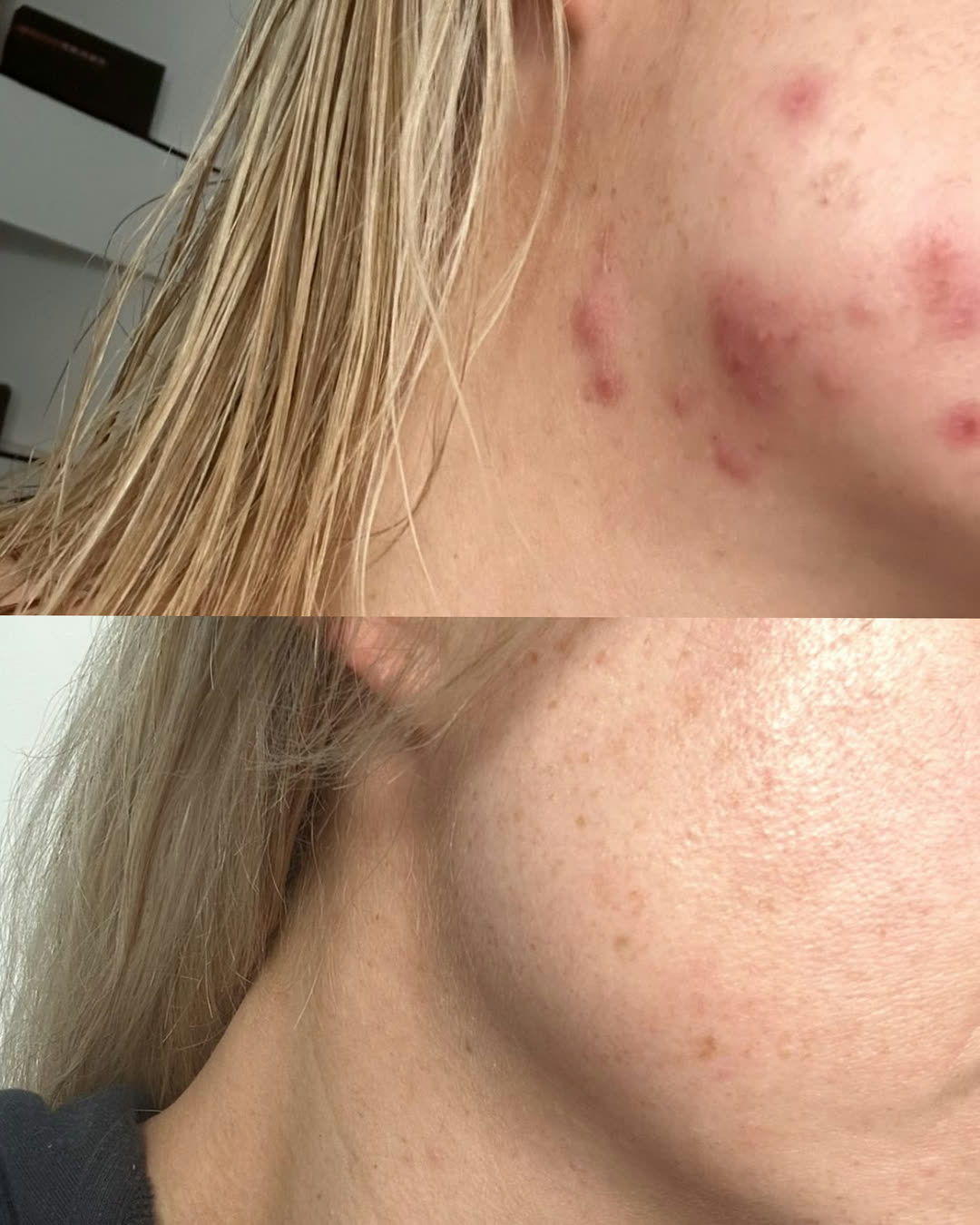 Skin treatment before and after