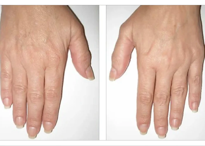 Hand Fillers Skipton