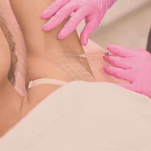 Hyperhidrosis Treatment Keighley