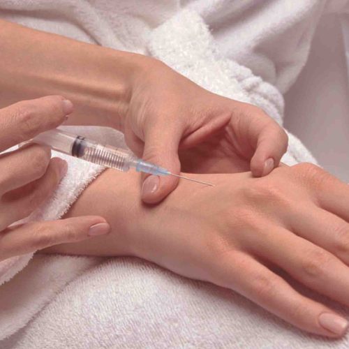 Hand Fillers Keighley