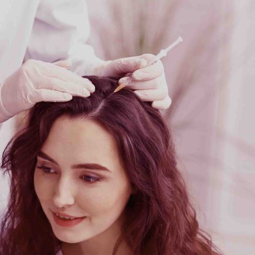 PRP Hair Restoration Keighley