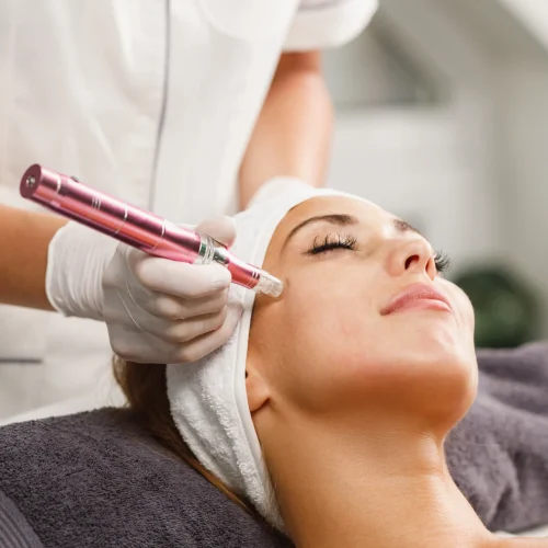 Microneedling in keighley Microneedling in keighley