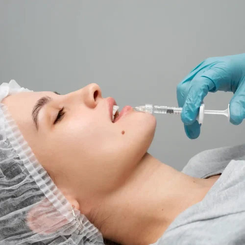 Lip Filler Skipton