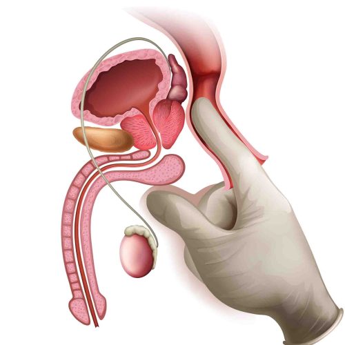 Penile Enlargement keighley