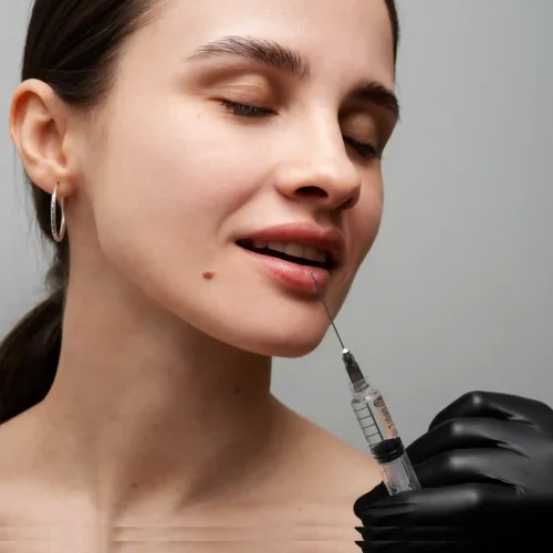 Lip Filler Skipton