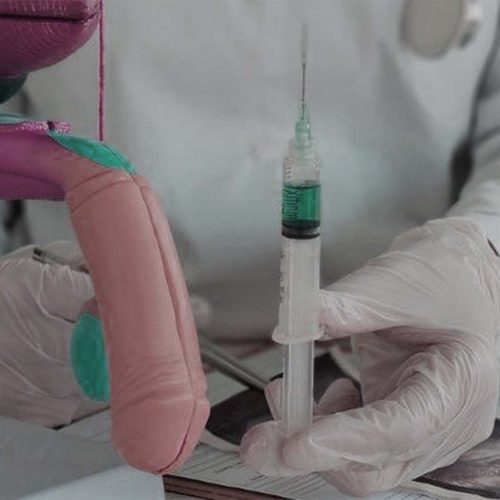 PRP for Erectile Dysfunction Keighley