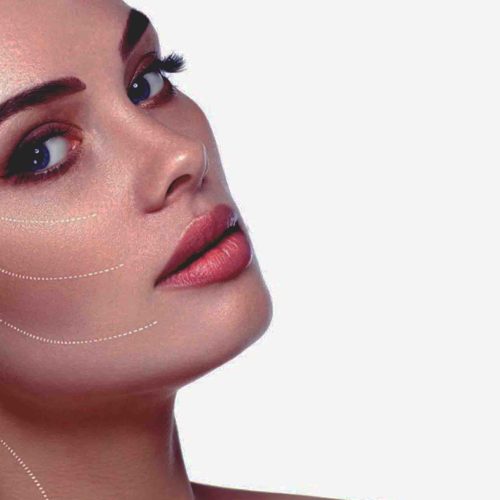 Non-Surgical Face Lift Keighley