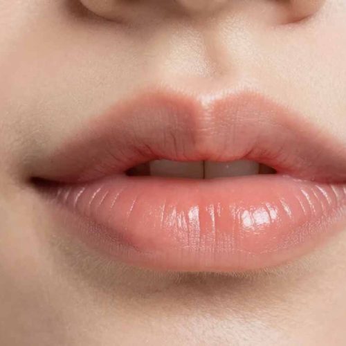 lip fillers keighley