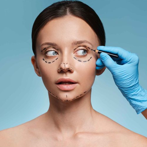 Xanthelasma Removal Skipton