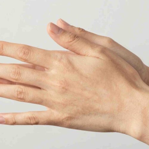 Hand Fillers Keighley