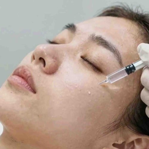 Non-Surgical Face Lift Keighley