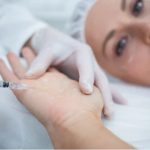 Hand Fillers Skipton