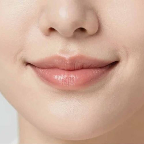 Peri-Oral Rejuvenation Keighley