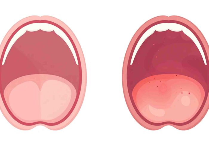 Vaginal Rejuvenation Keighley before and after