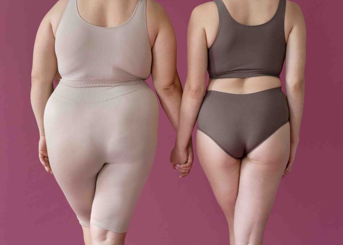 Medical Weight Loss Keighley Before and after Results