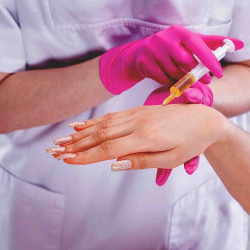 Hand Fillers Keighley