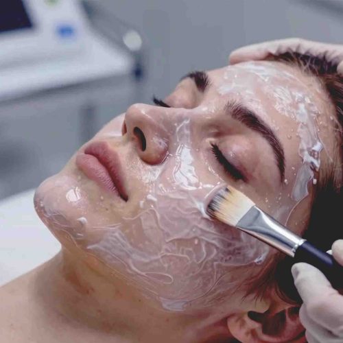 PRP Vampire Facial Keighley