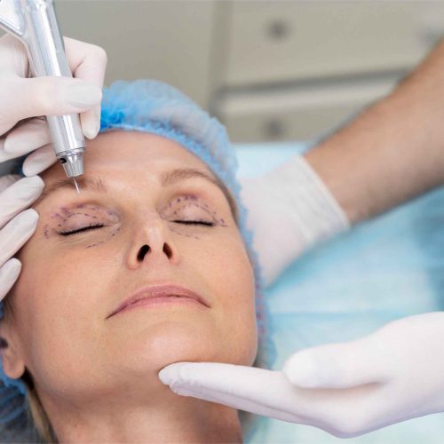 Xanthelasma Removal Skipton