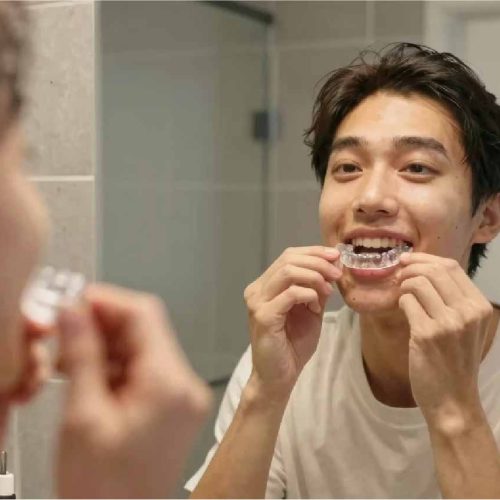 Bruxism Treatment Keighley