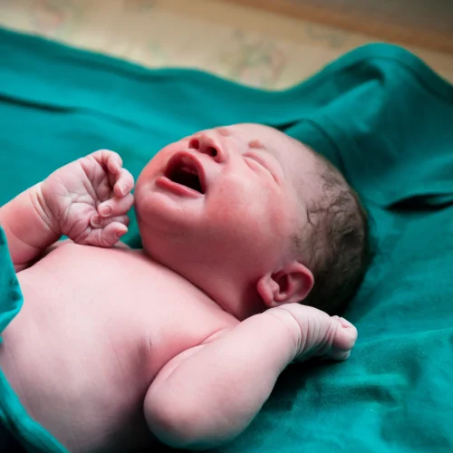 Circumcision keighley Circumcision keighley
