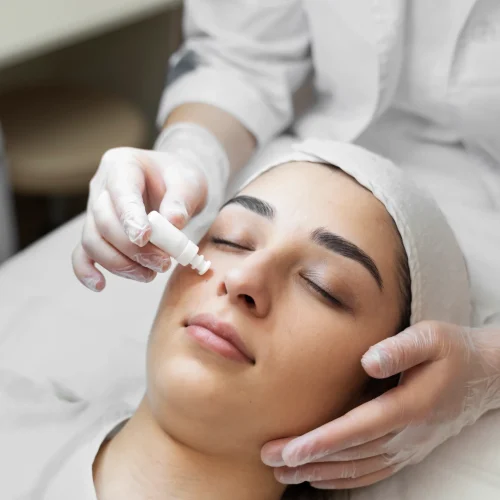 Microneedling at Pinnacle Clinic Microneedling at Pinnacle Clinic